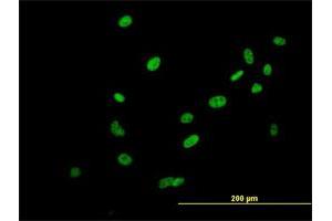 Immunofluorescence of purified MaxPab antibody to SAFB2 on HeLa cell. (SAFB2 Antikörper  (AA 1-528))