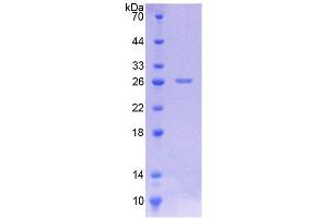 SDS-PAGE (SDS) image for Caspase 8 (CASP8) (AA 8-197) protein (His tag) (ABIN6236699)