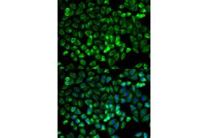 Immunofluorescence analysis of HeLa cells using TPSAB1 antibody. (TPSAB1 Antikörper)