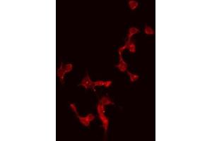 ABIN6274996 staining Hela by IF/ICC. (CBLN4 Antikörper  (Internal Region))