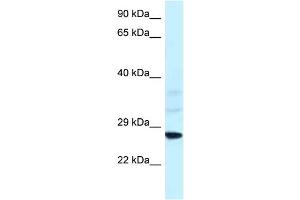 WB Suggested Anti-Snf8 Antibody   Titration: 1.
