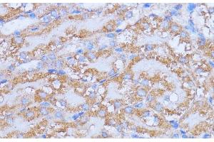 Immunohistochemistry of paraffin-embedded Mouse kidney using NME6 Polyclonal Antibody at dilution of 1:100 (40x lens). (NME6 Antikörper)