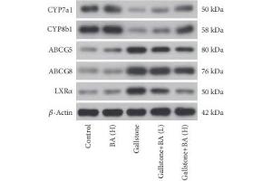 Western Blotting (WB) image for anti-ATP-Binding Cassette, Sub-Family G (WHITE), Member 8 (ABCG8) (AA 1-320) antibody (ABIN3022643)
