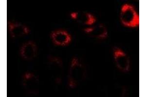 Immunofluorescent analysis of CCT3 staining in U2OS cells. (CCT3 Antikörper)