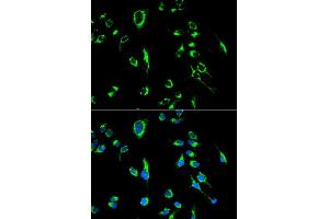 Immunofluorescence analysis of MCF7 cell using APOBEC3G antibody. (APOBEC3G Antikörper  (AA 60-330))