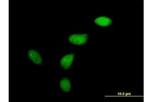 Immunofluorescence of purified MaxPab antibody to WEE1 on HeLa cell.