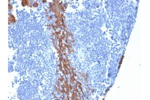 Immunohistochemistry (IHC) image for anti-Keratin 13 (KRT13) antibody (ABIN6939905)