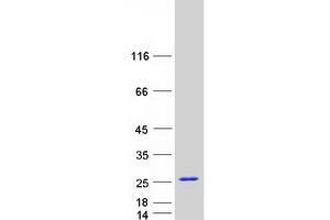 Western Blotting (WB) image for Stathmin 1 (STMN1) (Transcript Variant 3) protein (Myc-DYKDDDDK Tag) (ABIN2732832)