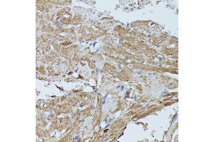 Immunohistochemistry of paraffin-embedded mouse heart using FLII antibody (ABIN7267217) at dilution of 1:100 (40x lens). (FLII Antikörper  (AA 400-660))