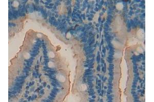 DAB staining on IHC-P; Samples: Mouse Intestine Tissue (ACP5 Antikörper  (AA 28-286))