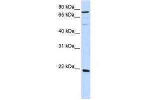 ARL11 antibody used at 1 ug/ml to detect target protein. (ARL11 Antikörper  (Middle Region))