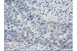 Immunohistochemical staining of paraffin-embedded Ovary tissue using anti-PORmouse monoclonal antibody. (POR Antikörper)