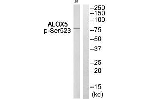 Western blot analysis of extracts from Jurkat cells, using ALOX5 (Phospho-Ser523) Antibody. (ALOX5 Antikörper  (pSer523))
