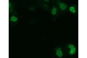 Anti-UCK1 mouse monoclonal antibody (ABIN2453771) immunofluorescent staining of COS7 cells transiently transfected by pCMV6-ENTRY UCK1 (RC220876). (UCK1 Antikörper)