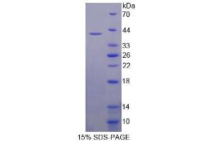 SDS-PAGE analysis of Human APBB1 Protein.
