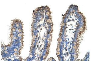 RHOBTB1 antibody was used for immunohistochemistry at a concentration of 4-8 ug/ml to stain Epithelial cells of intestinal villus (arrows) in Human Intestine. (RHOBTB1 Antikörper  (Middle Region))