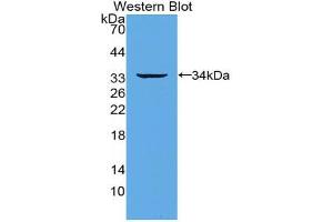 Western blot analysis of the recombinant protein. (TNFRSF11A Antikörper  (AA 330-615))