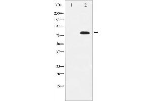 Western blot analysis of Rel expression in MDA-MB-435 whole cell lysates,The lane on the left is treated with the antigen-specific peptide. (c-Rel Antikörper  (Internal Region))
