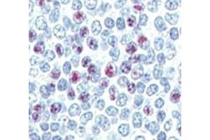 Immunohistochemistry (IHC) image for anti-Lin-28 Homolog B (LIN28B) (AA 95-128) antibody (ABIN3031627)