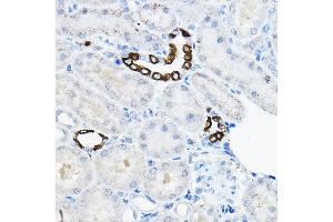 Immunohistochemistry of paraffin-embedded rat kidney using EVA Rabbit pAb  at dilution of 1:100 (40x lens). (TMEM166 Antikörper)