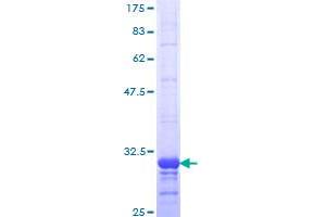 Image no. 1 for Chemokine (C-C Motif) Receptor 2 (CCR2) (AA 1-42) protein (GST tag) (ABIN1348495)