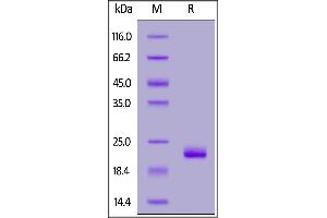 Human ZNRF3, His Tag on  under reducing (R) condition. (ZNRF3 Protein (AA 56-219) (His tag))