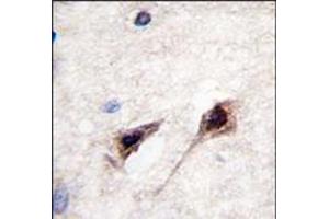 Image no. 1 for anti-Myocyte Enhancer Factor 2C (MEF2C) (Ser387) antibody (ABIN358801) (MEF2C Antikörper  (Ser387))