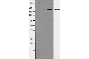 Western blot analysis of Integrin β4 expression in HepG2 cells. (Integrin beta 4 Antikörper  (C-Term))