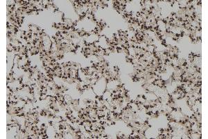 ABIN6272928 at 1/100 staining Rat lung tissue by IHC-P.