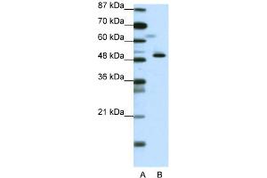 WB Suggested Anti-ZNF259 Antibody Titration:  0. (ZNF259 Antikörper  (N-Term))