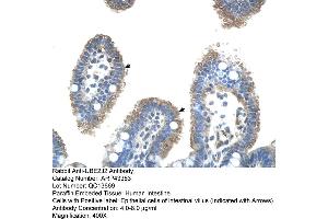 Human Intestine (UBE2J2 Antikörper  (C-Term))