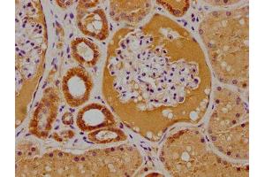 IHC image of ABIN7156191 diluted at 1:100 and staining in paraffin-embedded human kidney tissue performed on a Leica BondTM system. (PTK7 Antikörper  (AA 772-1070))