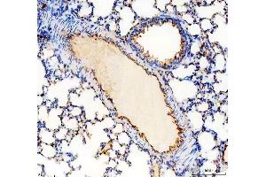IHC analysis of CD31/Pecam1 using anti-CD31/Pecam1 antibody (ABIN7601662). (CD31 Antikörper  (AA 41-258))