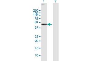 Western Blot analysis of WDR19 expression in transfected 293T cell line by WDR19 MaxPab polyclonal antibody. (WDR19 Antikörper  (AA 1-437))