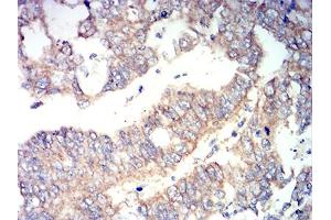 Immunohistochemistry (IHC) image for anti-Runt-Related Transcription Factor 3 (RUNX3) (AA 294-429) antibody (ABIN5611280)