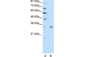 WB Suggested Anti-PITX3 Antibody Titration:  0.