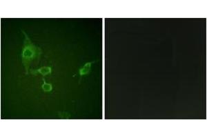 Immunofluorescence analysis of HepG2 cells, using HCK (Ab-410) Antibody. (HCK Antikörper  (AA 381-430))