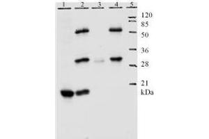 anti-Human Papilloma Virus 11 E7 (HPV-11 E7) (AA 1-35), (N-Term) antibody