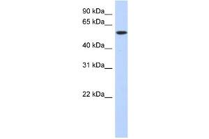WB Suggested Anti-DNTT Antibody Titration: 0. (TdT Antikörper  (Middle Region))