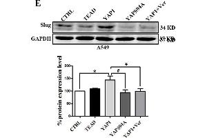 Slug is regulated by the co-transcriptional complex YAP1/TEAD in the EMT program of A549 cells. (GAPDH Antikörper)