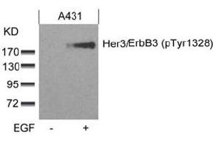 Image no. 2 for anti-Receptor Tyrosine-Protein Kinase ErbB-3 (ERBB3) (pTyr1328) antibody (ABIN319273) (ERBB3 Antikörper  (pTyr1328))
