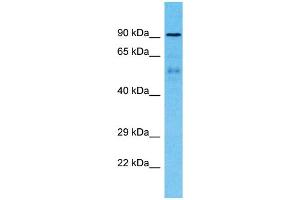 Host:  Rabbit  Target Name:  ZNF658B  Sample Type:  Breast Tumor lysates  Antibody Dilution:  1. (ZNF658B Antikörper  (Middle Region))