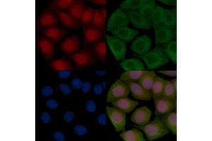 ABIN7093235 and ABIN7097247 staining Hela cells(45 min of heat-shock treatment) by IF/ICC. (FOXO3 Antikörper  (acLys290))