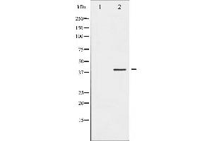 Western blot analysis of Fos phosphorylation expression in forskolin treated K562 whole cell lysates,The lane on the left is treated with the antigen-specific peptide. (c-FOS Antikörper  (pSer362))