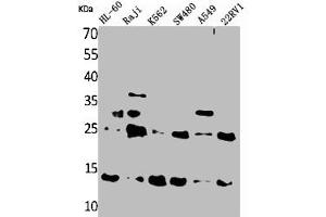 Western Blot analysis of HL-60 Raji K562 SW480 A549 22RV-1 cells using TRP14 Polyclonal Antibody (TXNDC17 Antikörper  (Internal Region))