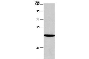 Western Blot analysis of 293T cell using HDAC8 Polyclonal Antibody at dilution of 1:950 (HDAC8 Antikörper)