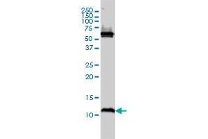 ATPIF1 monoclonal antibody (M01), clone 3E2 Western Blot analysis of ATPIF1 expression in MCF-7 . (ATPase Inhibitory Factor 1 Antikörper  (AA 1-106))