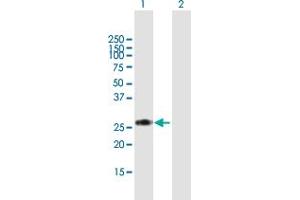 Western Blot analysis of RPIA expression in transfected 293T cell line by RPIA MaxPab polyclonal antibody.