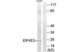 Western Blotting (WB) image for anti-Eukaryotic Translation Initiation Factor 4E Family Member 3 (EIF4E3) (AA 141-190) antibody (ABIN2890315)