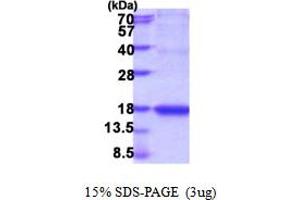 SDS-PAGE (SDS) image for Interleukin 18 (IL18) (AA 36-192) protein (ABIN6387557)